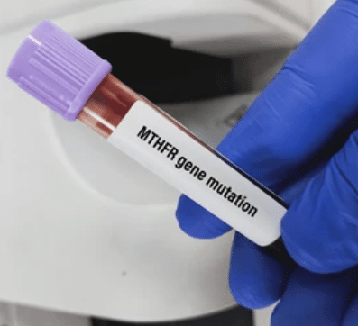 MTHFR Gene Mutation Blood Test