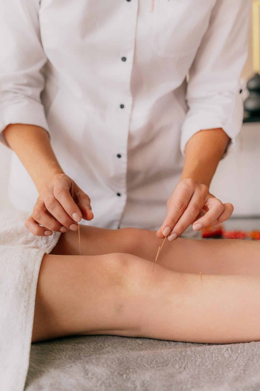 person receives acupuncture on the knees